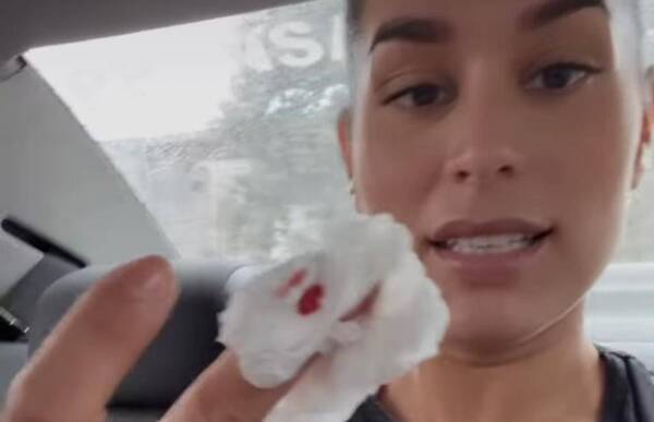 Crónica / Fabi Martínez: "¡No puedo creer... Destruí mi dedo!"