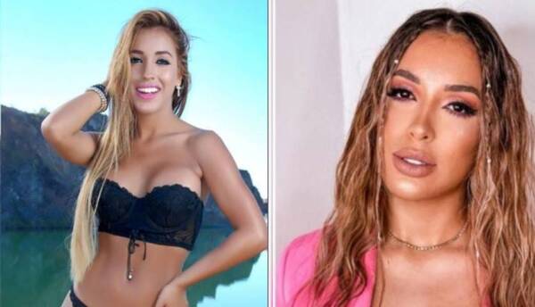 Crónica / ¿Qué le pasó? Modelo apareció con otra cara