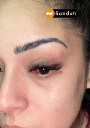 A una semana de brutal agresión a mujer, Fiscalía no imputa al supuesto autor