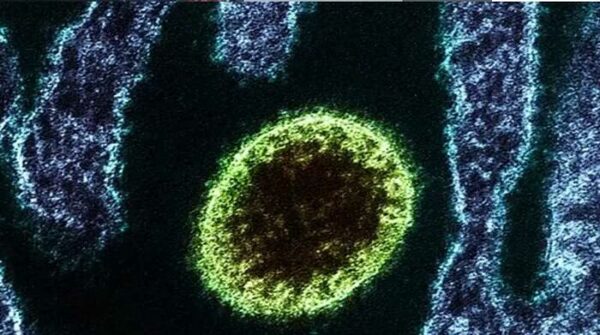 Diario HOY | Decenas de personas infectadas en China con nuevo virus Langya: lo que se sabe hasta ahora