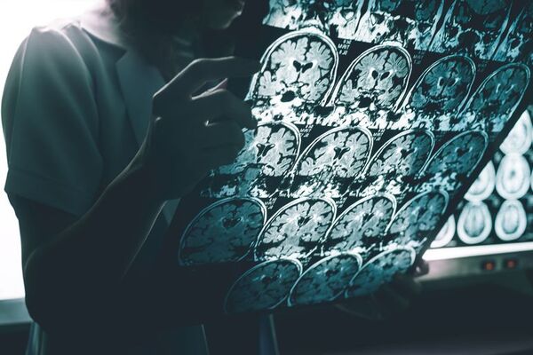 El esfuerzo mental agota físicamente - Ciencia - ABC Color