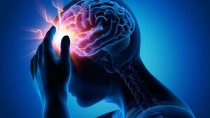 Neurólogo explica formas de salvar a una persona con ACV - Nacionales - ABC Color