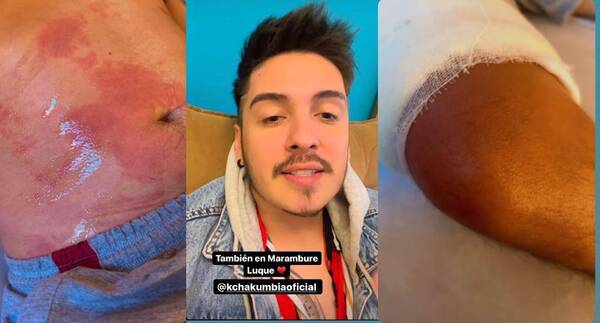 Crónica / Will Fretes: "Rengueando me van a llevar al escenario, pero me voy a subir"