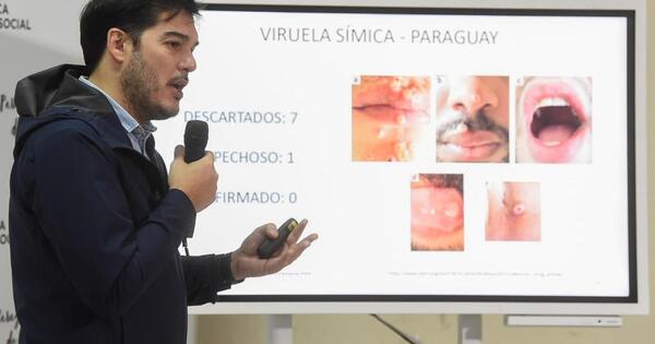 Salud descartó casos de viruela del mono en el país