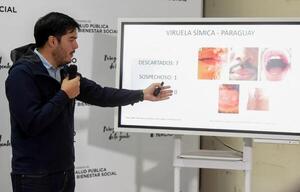 Descartan casos de viruela del mono en el país