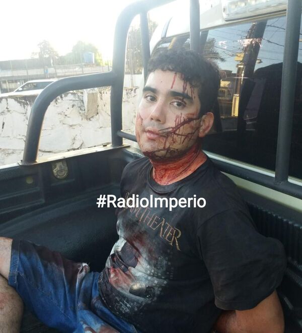 Propinó siete estocadas a una niñera por no prestarle cable USB - Radio Imperio