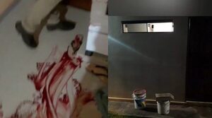 Delincuentes entran a una casa para robar y disparan al dueño en la cara - Noticiero Paraguay