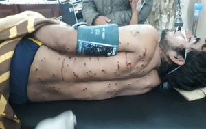 Hieren con escopeta a un joven en un confuso episodio en Caaguazú – Prensa 5