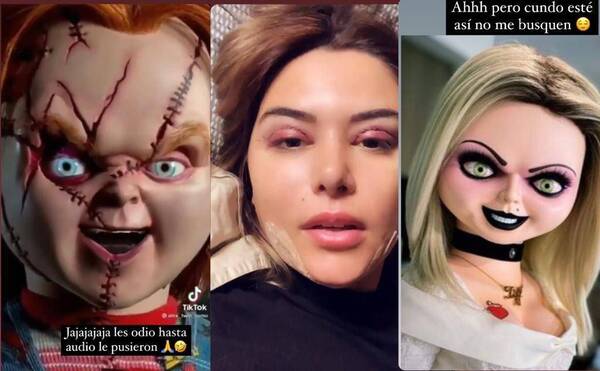 Crónica / ¡No vaseo! Se operó y le compararon con Chucky