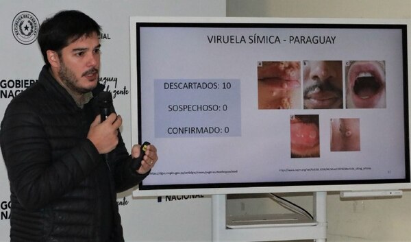 Diario HOY | Otra semana sin casos de viruela del mono: 10 sospechosos, descartados