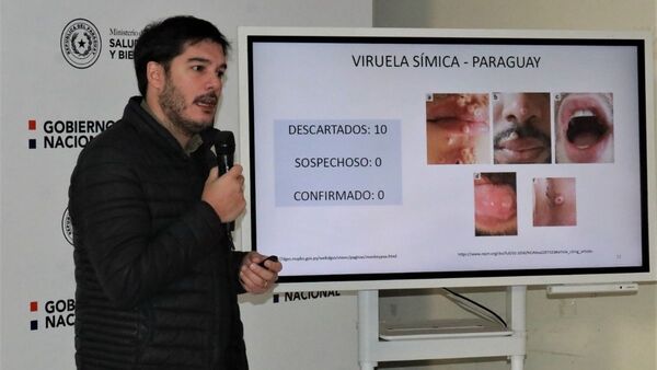 Salud habilita chat para que se animen a consultar sobre viruela del mono