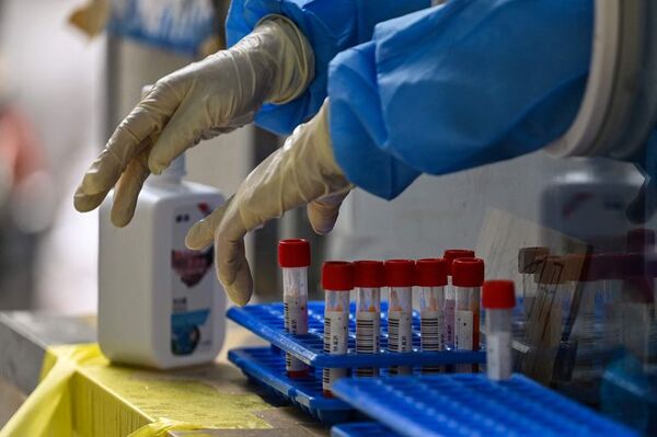 Coronavirus: la semana cerró con 35 fallecidos a causa de la enfermedad - Nacionales - ABC Color