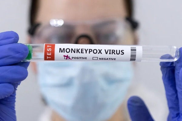 Diario HOY | ¿La viruela del mono es igual a COVID-19?