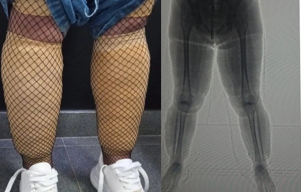 Paraguaya es detenida con cocaína en su cuerpo en Brasil - Noticiero Paraguay