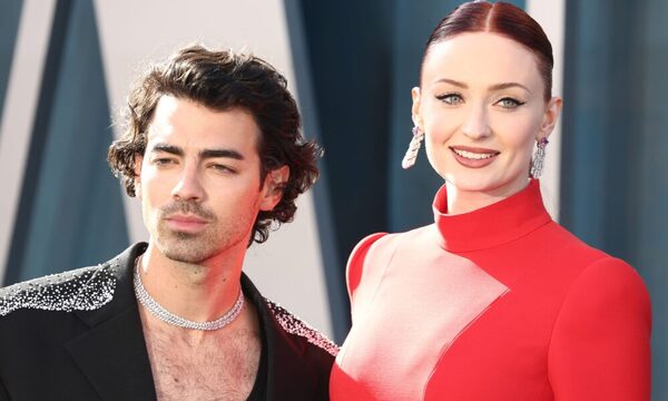 Joe Jonas habla sobre los retoques estéticos a los que se ha sometido