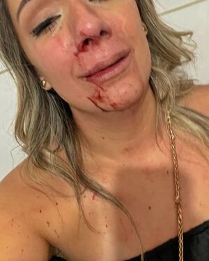 Abogada de joven que denunció a su pareja por agresión sostiene que fiscal imputó por un hecho leve - PDS RADIO