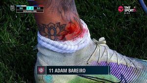 Impactante infracción sobre Adam Bareiro