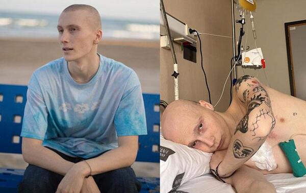 Muere Charlie, el 'tiktoker' de 20 años que luchaba contra un cáncer terminal – Prensa 5
