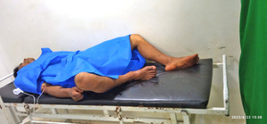 Motochorro herido durante asalto es detenido al ingresar al hospital - La Clave