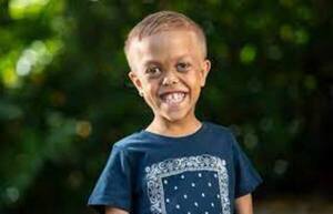 Niño que sufría bullying al punto de querer suicidarse ahora será estrella de Hollywood | OnLivePy