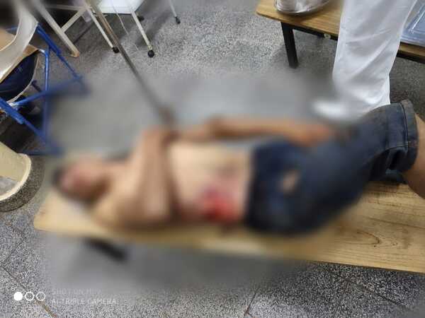A puñaladas hieren gravemente a un joven en el barrio San Isidro de Encarnación