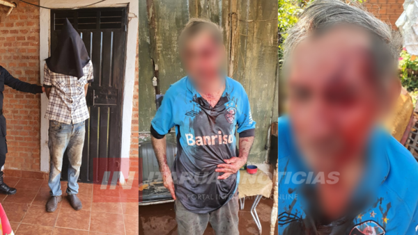 MACHETEÓ BRUTALMENTE A SU PADRASTRO Y TERMINÓ PRESO