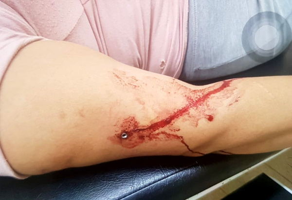 Mitã’i salvaje trepa una muralla y dispara con rifle de aire comprimido a una doña - La Clave