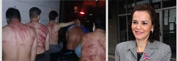 Fiscal y médico ratifican existencia de tortura, pero pesquisas no tienen avances significativos - PDS RADIO