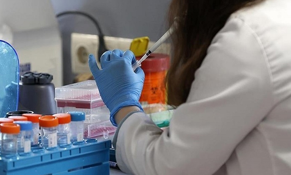 Viruela del mono: Paraguay negocia adquisición de vacunas - OviedoPress