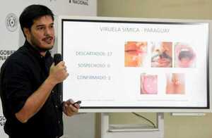 Primer caso de viruela símica provino del Brasil | 1000 Noticias