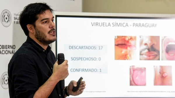 Viruela: Aislamiento debe ser 21 días desde primer síntoma