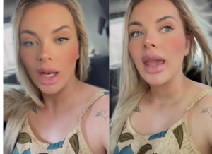 Le dijeron a modelo que deformó sus labios y ella responde: “Cada uno con su gusto”
