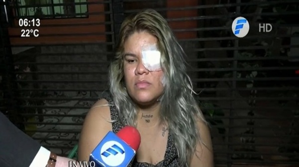 Habló la joven baleada por motochorros en Ñemby - Paraguaype.com