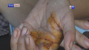 Víctima de intento de feminicidio pide justicia y teme por su vida - Paraguaype.com