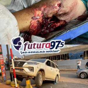 Turista argentino perdió el brazo tras accidente en PJC