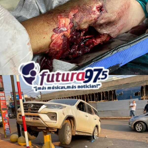 Turista argentino perdió el brazo tras accidente en PJC