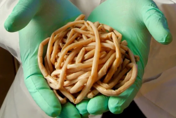 Extraen parásito intestinal de 40 centímetros a bebé de un año en Capiatá - Noticiero Paraguay