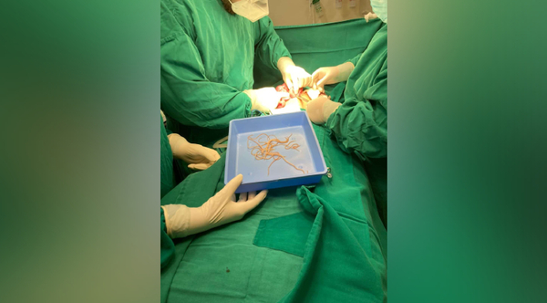 Diario HOY | Infección por parásitos intestinales: síntomas y cómo evitarlos