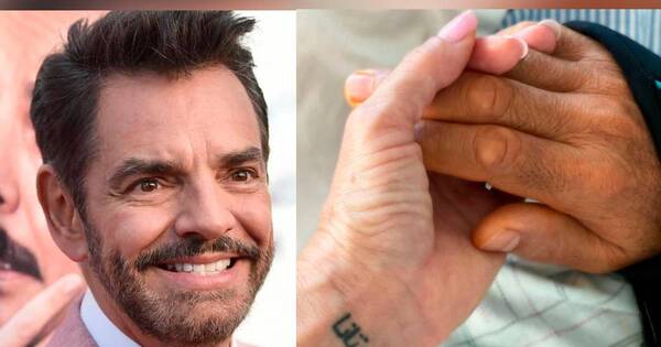La Nación / Eugenio Derbez “se está recuperando” tras ser sometido a una cirugía