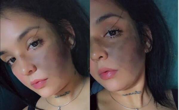 Crónica / [VIDEO] ¡Cantante fue garroteada por pelotero!