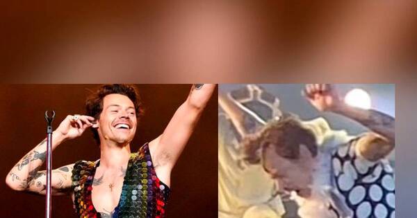 La Nación / Harry Styles se pronuncia sobre el rumor de su “calvicie”