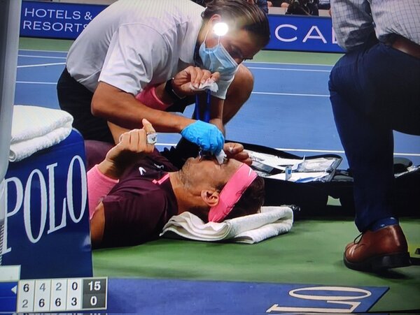 Diario HOY | Nadal y el susto final ante Fognini: "Pensé que me había roto la nariz"