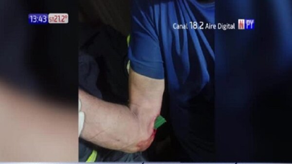 Reja de un portón quedó incrustado en el brazo de un hombre | Noticias Paraguay