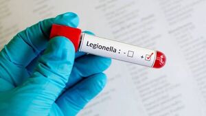 Legionella en Argentina no es motivo de alerta en Paraguay, asegura Salud Pública - Nacionales - ABC Color
