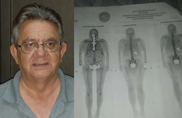 Preso hará huelga de hambre para que lo dejen "morir al lado de su familia" - Noticiero Paraguay