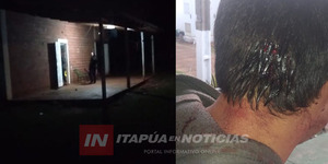 LE DIO UN MACHETAZO A SU PROPIO HIJO TRAS UNA DISCUSIÓN