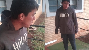Hombre sup. agredió brutalmente con un machete a su hijo