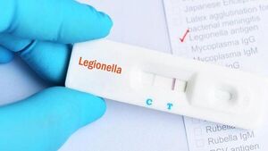 Ya son seis los fallecidos por Legionella en Argentina - Mundo - ABC Color