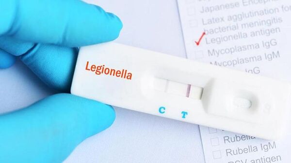 Ya son seis los fallecidos por Legionella en Argentina - Mundo - ABC Color