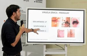 Viruela del mono: Sequera aclara quiénes deben usar tapabocas - Nacionales - ABC Color